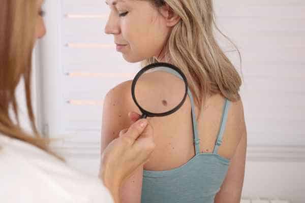 What Are Traditional Skin Lesion Removal Methods Royal Wootton Bassett?