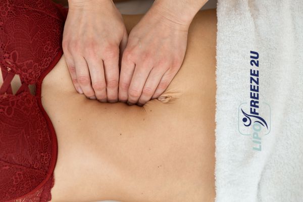 diastasis recti treatment Royal Wootton Bassett