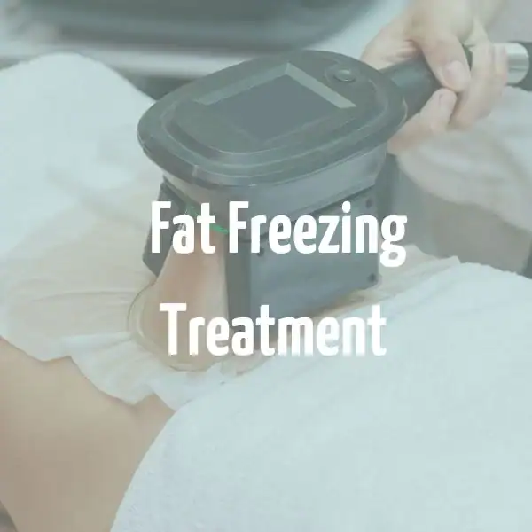 fat freezing treatment Royal Wootton Bassett