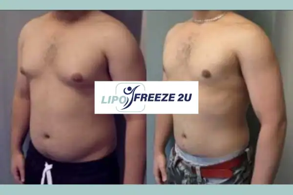 How Long Does It Take to See Results Royal Wootton Bassett?