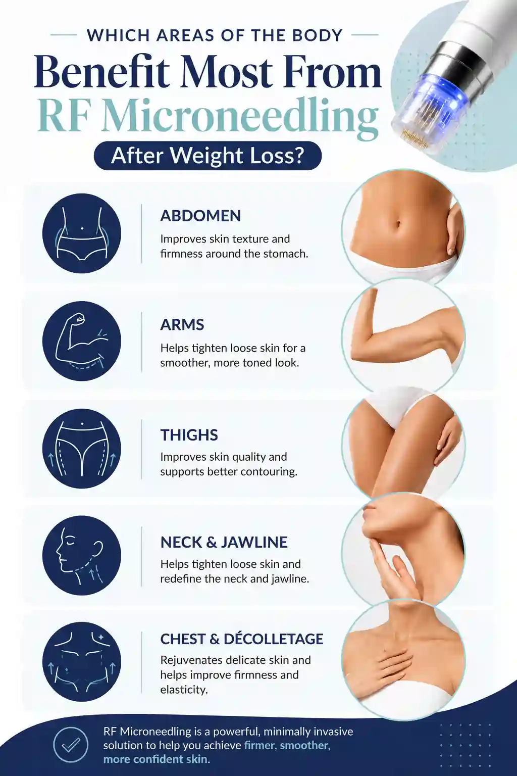 Which Areas of the Body Benefit Most From RF Microneedling After Weight Loss Royal Wootton Bassett